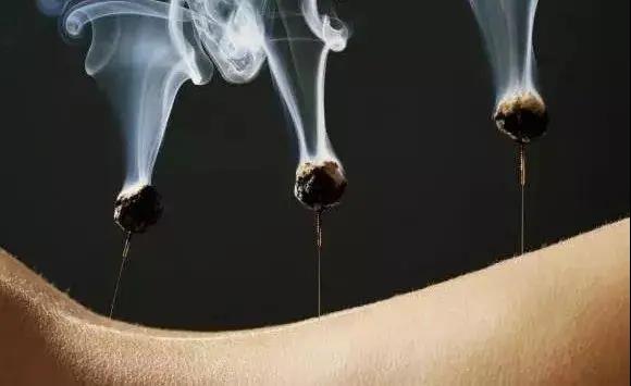 艾灸不是藥，調(diào)的不是病，央視為艾灸正名，讓我們正視艾灸