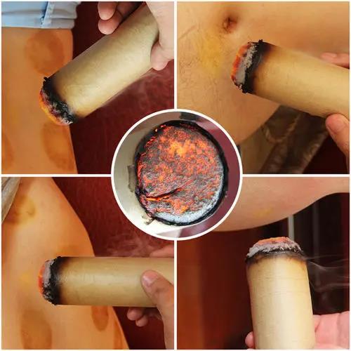 灸溫，到底是燙的好還是溫的好？為什么有的人感覺不到熱?
