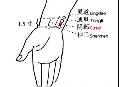 睡覺愛出汗，艾灸這幾個穴位