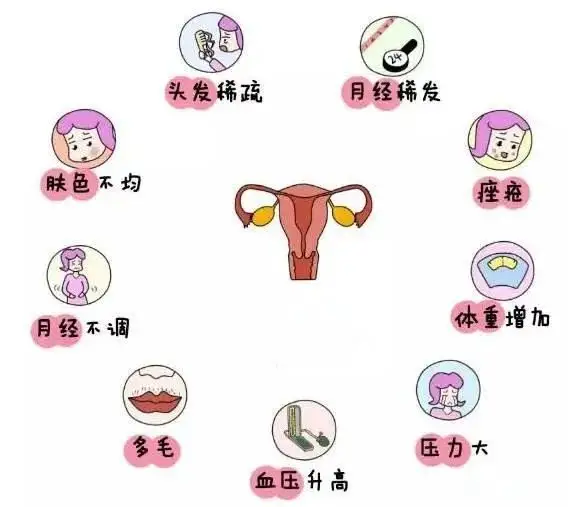 10個女人就有1個患多囊！被它纏上不要怕，艾灸幫你調(diào)“多囊”！